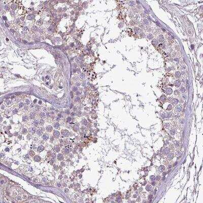 Immunohistochemistry: FAM183A Antibody [NBP2-33550]