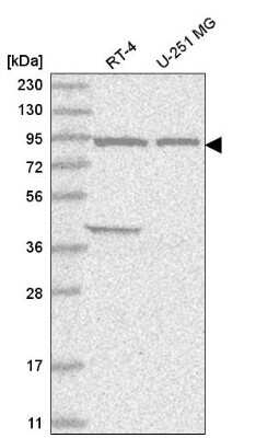 Western Blot: FAM184A Antibody [NBP2-56733]