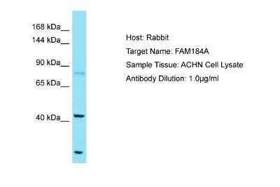 Western Blot: FAM184A Antibody [NBP2-87408]