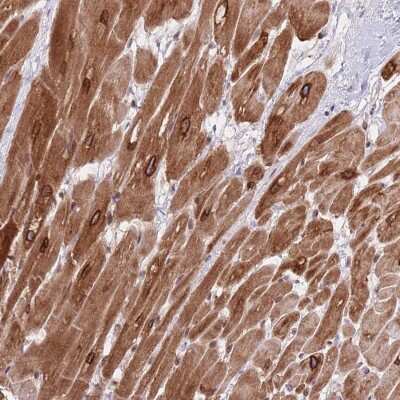 Immunohistochemistry: FAM184B Antibody [NBP2-48905]