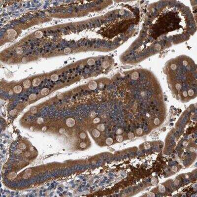 Immunohistochemistry-Paraffin: FAM185A Antibody [NBP1-93478]