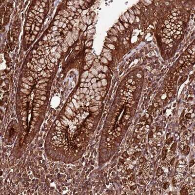 Immunohistochemistry-Paraffin: FAM186A Antibody [NBP1-93553]