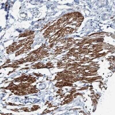 Immunohistochemistry-Paraffin: FAM187A Antibody [NBP1-91069]