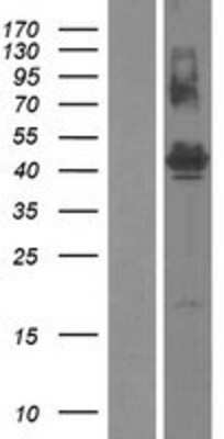 Western Blot: FAM187B Overexpression Lysate [NBP2-05353]