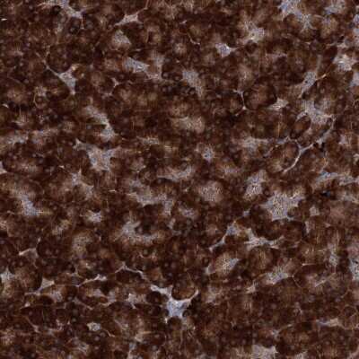 Immunohistochemistry: MINDY3 Antibody [NBP2-32634]