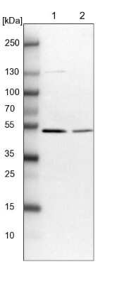 Western Blot: MINDY3 Antibody [NBP1-88543]