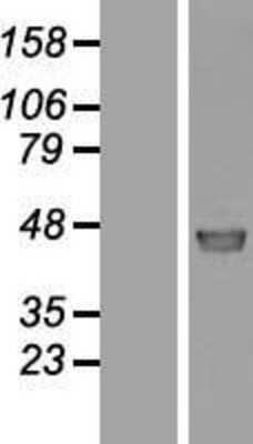 Western Blot: MINDY3 Overexpression Lysate [NBL1-08092]