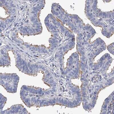 Immunohistochemistry-Paraffin: FAM188B Antibody [NBP1-91238]