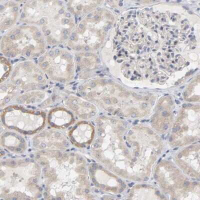 Immunohistochemistry-Paraffin: FAM188B Antibody [NBP1-91239]