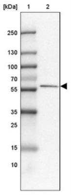 Western Blot: FAM189A1 Antibody [NBP1-93631]