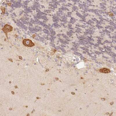 Immunohistochemistry: FAM189A2 Antibody [NBP2-38825]