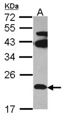 Western Blot: FAM18B Antibody [NBP1-31988]