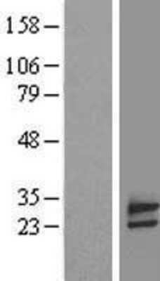 Western Blot: FAM18B Overexpression Lysate [NBL1-10505]