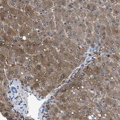 Immunohistochemistry-Paraffin: CDRT4 Antibody [NBP1-84559]