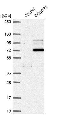 Western Blot: FAM190A Antibody [NBP1-82899]