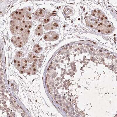 Immunohistochemistry-Paraffin: FAM190B Antibody [NBP1-81439]