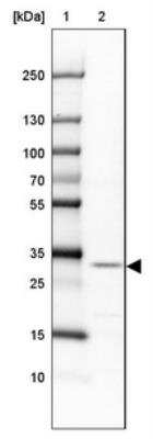 Western Blot: FAM190B Antibody [NBP1-81439]