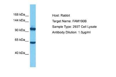 Western Blot: FAM190B Antibody [NBP2-84905]