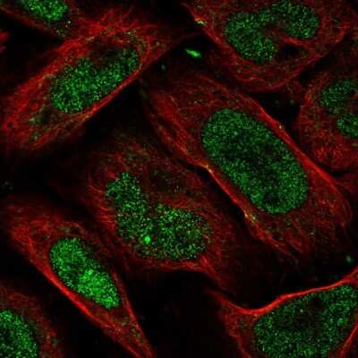 Immunocytochemistry/ Immunofluorescence: FAM193B Antibody [NBP2-58638]