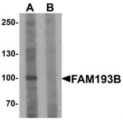 Western Blot: FAM193B AntibodyBSA Free [NBP2-81932]