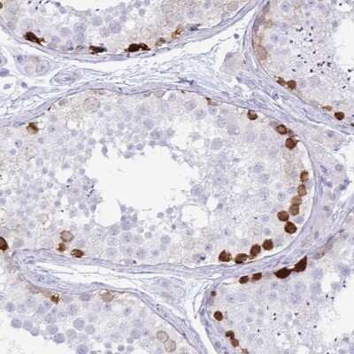 Immunohistochemistry-Paraffin: FAM194A Antibody [NBP2-14638]