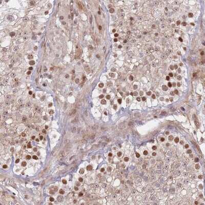 Immunohistochemistry-Paraffin: FAM194B Antibody [NBP2-31011]