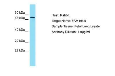 Western Blot: FAM194B Antibody [NBP2-82646]