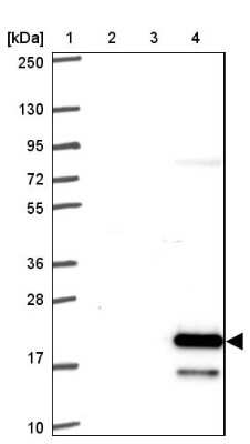 Western Blot: FAM195A Antibody [NBP2-32535]