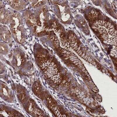 Immunohistochemistry-Paraffin: FAM195B Antibody [NBP2-14550]