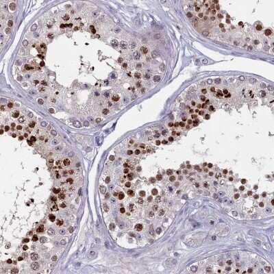 Immunohistochemistry: FAM196A Antibody [NBP2-48648]