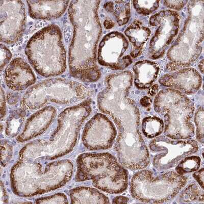 Immunohistochemistry: FAM196A Antibody [NBP2-48649]