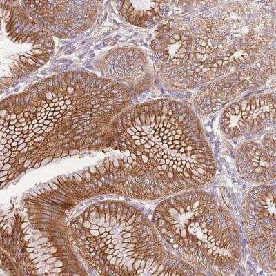 Immunohistochemistry-Paraffin: FAM196B Antibody [NBP2-14588]