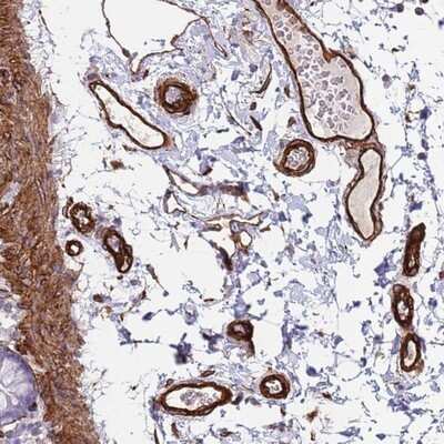 Immunohistochemistry-Paraffin: FAM198A Antibody [NBP1-94108]