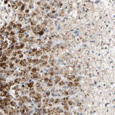 Immunohistochemistry-Paraffin: FAM198B Antibody [NBP1-86783]