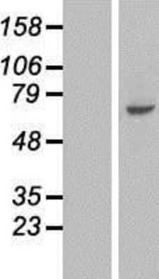 Western Blot: FAM198B Overexpression Lysate [NBL1-08464]