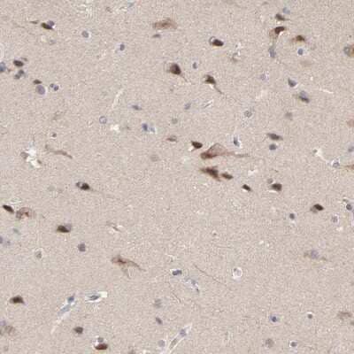 Immunohistochemistry-Paraffin: FAM199X Antibody [NBP1-90603]