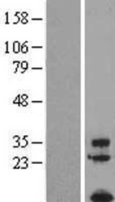 Western Blot: TAFA1/FAM19A1 Overexpression Lysate [NBL1-10507]