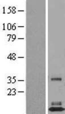 Western Blot: TAFA3/FAM19A3 Overexpression Lysate [NBL1-10509]