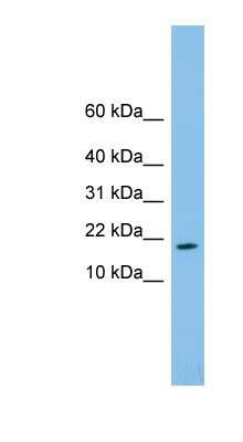 Western Blot: TAFA4/FAM19A4 Antibody [NBP1-59651]