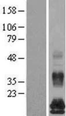 Western Blot: TAFA5/FAM19A5 Overexpression Lysate [NBL1-10512]