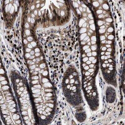 Immunohistochemistry: FAM200A Antibody [NBP1-91246]