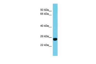 Western Blot: FAM204A Antibody [NBP2-84906]