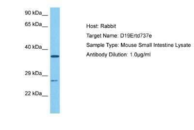 Western Blot: FAM204A Antibody [NBP2-84907]