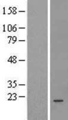 Western Blot: FAM204A Overexpression Lysate [NBL1-08088]