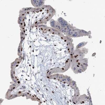 Immunohistochemistry-Paraffin: FAM206A Antibody [NBP1-84529]