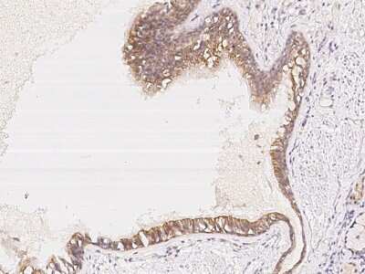 Immunohistochemistry-Paraffin: FAM206A Antibody [NBP2-98051]