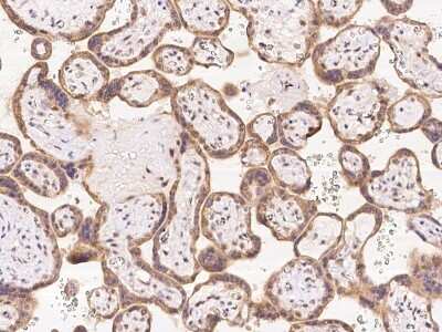 Immunohistochemistry-Paraffin: FAM206A Antibody [NBP2-98051]