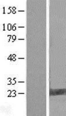 Western Blot: FAM206A Overexpression Lysate [NBL1-08598]