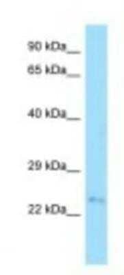 Western Blot: FAM207A Antibody [NBP1-98325]