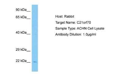 Western Blot: FAM207A Antibody [NBP2-84908]